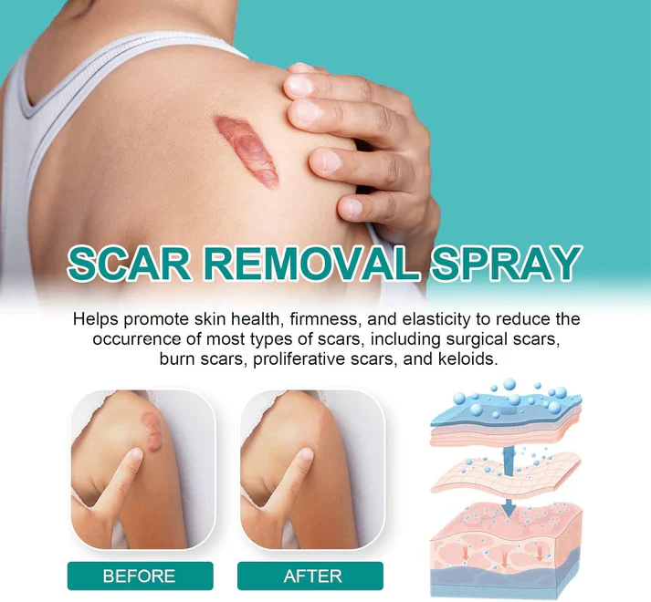 ScarRemove+ Advanced Spray Fade Scars - Image 3